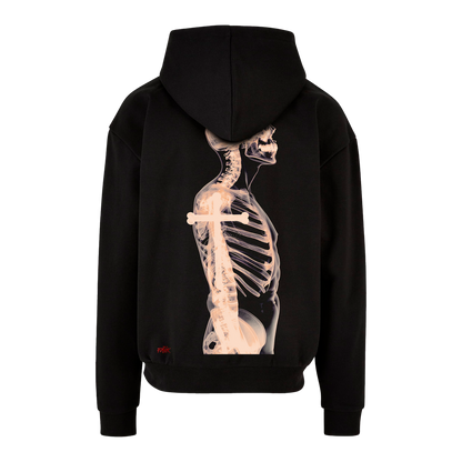 X Ray - Hoodie